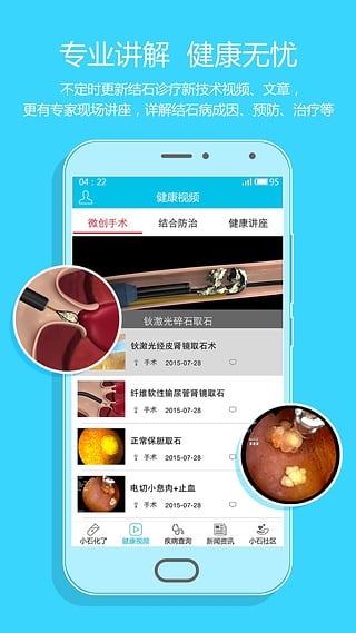 小石化了  v1.0.4图2